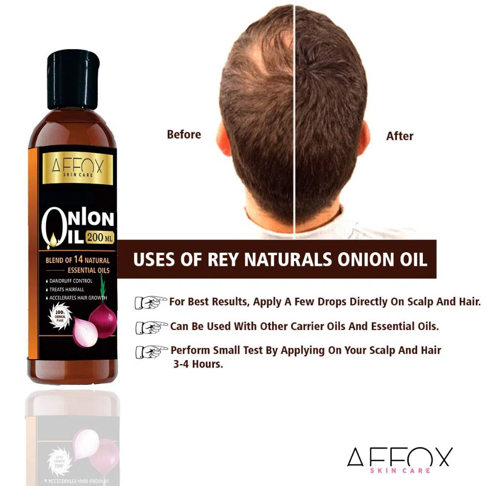 Onion Hair Oil With Brahmi, Bhringraj, Amla & Argan Oil- 200ML USA