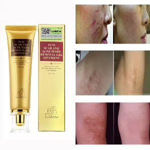 TCM Scar and Acne Mark Removal Gel Ointment Smooth Skincare Gel 30g. THAILAND