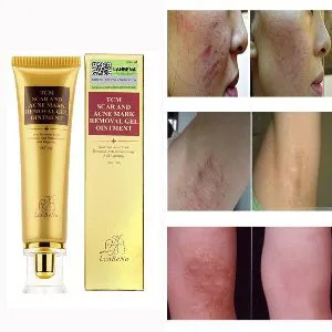 TCM Scar and Acne Mark Removal Gel Ointment Smooth Skincare Gel 30g.
