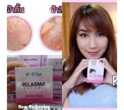 P Vita Melasma Cream-10gm-Thailand 1pcs