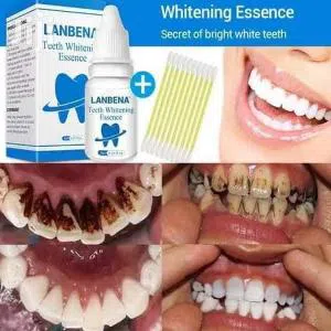 Lanbena Teeth whitening essence 10ml China