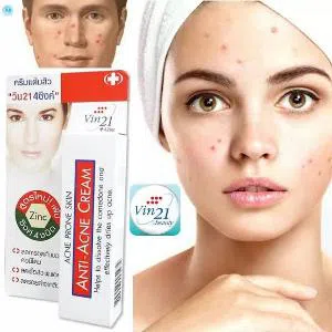 VIN21 + 4 Zinc Anti-Acne Cream 10ml Thailand 